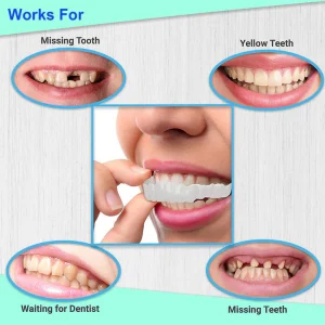 StoreTom Unisex Snap-On Veneers  | Natural Look | Instant Smile | BPA-Free| 1 pair (Uper and lower) photo review